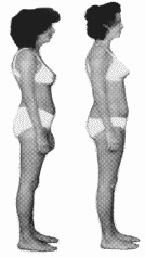 Woman-BeforeAndAfter-rolfing-1